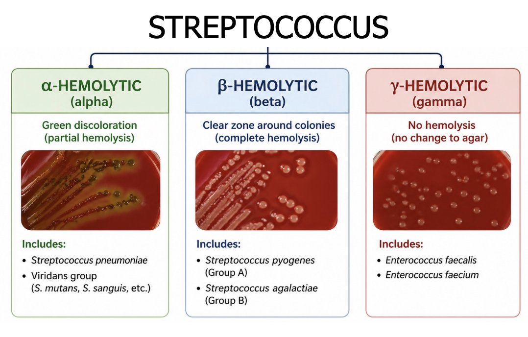 <p><strong><mark data-color="blue" style="background-color: blue; color: inherit;">Hemolysis (blood agar) - bact growth medium</mark></strong></p><ul><li><p>for identifying bact based on <strong><u>ability to lyse RBC</u></strong></p></li><li><p>important for streptococci classif</p></li><li><p>caused by hemolysins (toxins)</p></li></ul><p></p><p><mark data-color="blue" style="background-color: blue; color: inherit;">3 types of hemolysis (based on cell wall antigen)</mark></p><p></p><ol><li><p><mark data-color="yellow" style="background-color: yellow; color: inherit;">Alpha (α) = partial breakdown (of rbc)</mark></p></li></ol><ul><li><p>narrow zone of partial hemolysis</p></li><li><p>greenish discoloration around colony</p></li><li><p>ex: pneumonia</p></li></ul><p></p><ol start="2"><li><p><mark data-color="yellow" style="background-color: yellow; color: inherit;">Beta (β) (4 types) = complete breakdown</mark></p></li></ol><ul><li><p>complete hemolysis</p></li><li><p>clear/translucent zone of complete hemo around colonies</p></li><li><p>more developed in liquid than solid media</p></li><li><p>ex: pyogenes</p></li></ul><p></p><p><mark data-color="purple" style="background-color: purple; color: inherit;">group A = Streptococc pyogenes (GAS)</mark></p><p><u>Common infects</u></p><ul><li><p>strep throat (pharyngitis)</p></li><li><p>scarlet fever</p></li><li><p>necrotizing fascitis</p></li></ul><p></p><p><u>Post-infect complication</u></p><ul><li><p><strong>rheumatic fever</strong></p></li><li><p>acute glomerulonephritis</p></li></ul><p></p><p><mark data-color="purple" style="background-color: purple; color: inherit;">group B = Streptococcus agalactiae (GBS)</mark></p><p><u>Neonatal infects*</u></p><ul><li><p>meningitis</p></li><li><p>sepsis</p></li></ul><p></p><ul><li><p>colonize fem reprod tract</p></li><li><p><strong>screening for GBS 35-37 weeks preg*</strong></p></li><li><p>intrapartum antibiotics prev transmit when labour</p></li></ul><p></p><p><mark data-color="purple" style="background-color: purple; color: inherit;">group C</mark></p><ul><li><p>primarily <strong>animal pathogens*</strong> (rare in human)</p></li></ul><p></p><p><mark data-color="purple" style="background-color: purple; color: inherit;">group D = </mark><strong><mark data-color="purple" style="background-color: purple; color: inherit;">Enterococcus*</mark></strong></p><ul><li><p>usually gamma hemolytic (no hemolysis)</p></li><li><p>common species = enteroccocus faecalis, faecium</p></li></ul><p></p><p><strong>clinical relev of group D</strong></p><ul><li><p><strong>opportunistic infects</strong></p></li><li><p><strong>often antibiotic resist</strong></p></li><li><p>important in hospital-acquired infects</p></li></ul><p></p><ol start="3"><li><p><mark data-color="yellow" style="background-color: yellow; color: inherit;">Gamma (γ) = no breakdown</mark></p></li></ol><ul><li><p>no hemolysis</p></li><li><p>ex: nonhaemolytic strept</p></li></ul><p></p><p><span style="color: red;">note that </span><span style="color: red;">β (complete) & γ (none) for hemolysis</span></p><div data-type="horizontalRule"><hr></div><p></p><p><strong>clinical relev</strong></p><ul><li><p>opportunistic infects</p></li><li><p>often antibiotic resist</p></li><li><p>important in hospital-acquired infects</p></li></ul><p></p>
