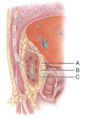 <p>This is composed of dense irregular tissue that runs continuous with the ureter.</p>