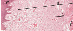 <p>What type of epithelium is indicated by the arrow labeled as A in this slide of a dog's lip?</p>