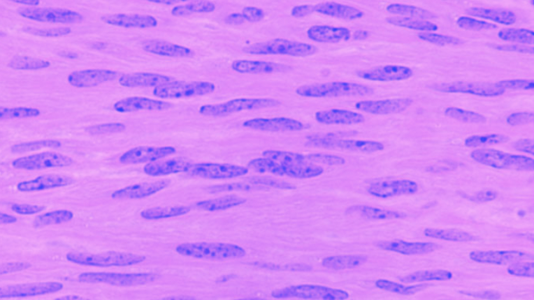 <p>no stripes and no sarcomeres, 1 nuclei per cell, low mitochondria</p>