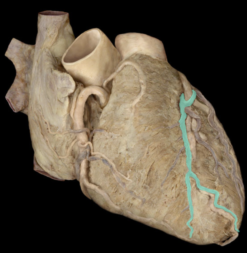 <p>Identify the coronary vein</p>