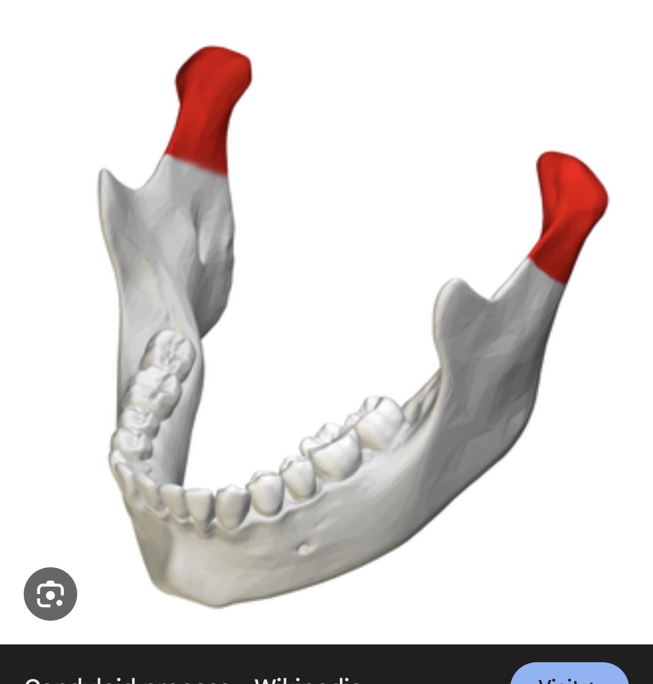 <p>what is this?R/L</p>