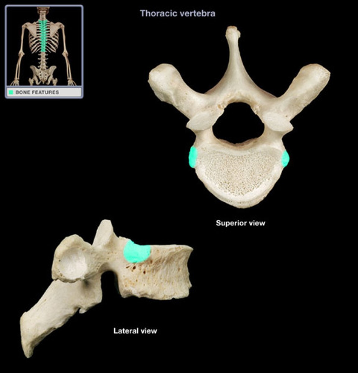<p>Rib attachment (upper)</p>