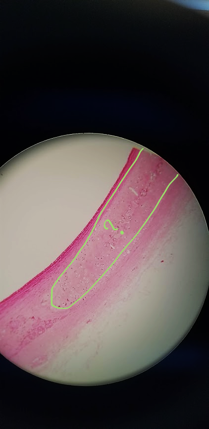 <p>what is outlined?</p>