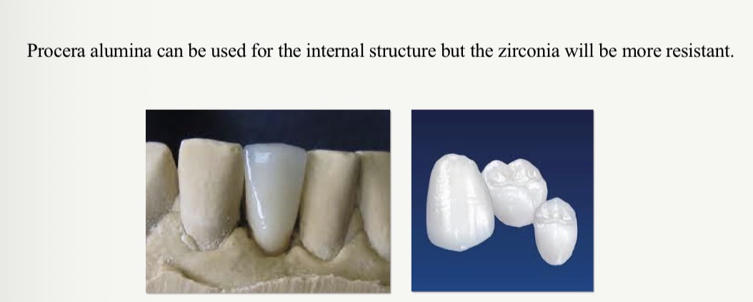 <p>Very opaque- use for internal structures then cover with conventional porcelains for good aesthetics</p><p>Lower flexural strength than polycrystalline</p><p>Less resistant</p>