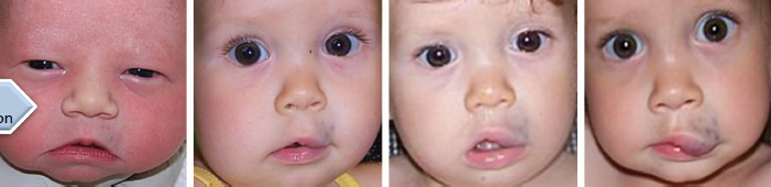 <ul><li><p>are present at birth</p></li><li><p>no rapid increase in size</p></li><li><p>no involution</p></li></ul><p></p>