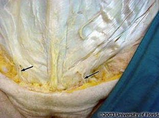 <p>what nerve is being indicated to in the image</p>