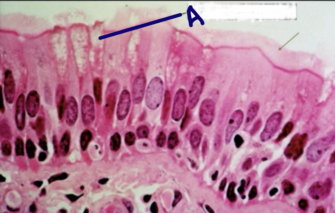<p>What cell is A?</p>