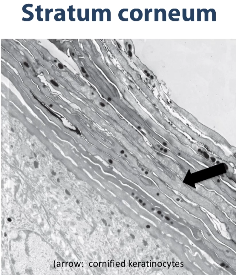 <p>So here we have an electron micrograph of the superficial most layer of the stratified keratinized squamous epithelium. </p><p>You can see the corneal layer in this electron micrograph. Notice what we have here are the remnants of the cells that were generated below on this epithelium (the epithelium is the lighter gray towards the bottom of the photo). </p><p>As they mature, the cells move up in the epithelium (into the darker grey) and at some point, as you see, they shed their organelles, having made a lot of this intermediate filament protein known as keratin and they become the superficial most layer of our skin offering a lot of protection.</p><p>Keratin is a waxy protein that offers some protection against water loss and against foreign pathogens, so that’s what you are seeing in this image. </p><p>The dark granules are the remnants up some pigment that are in these empty bags of cells. </p>