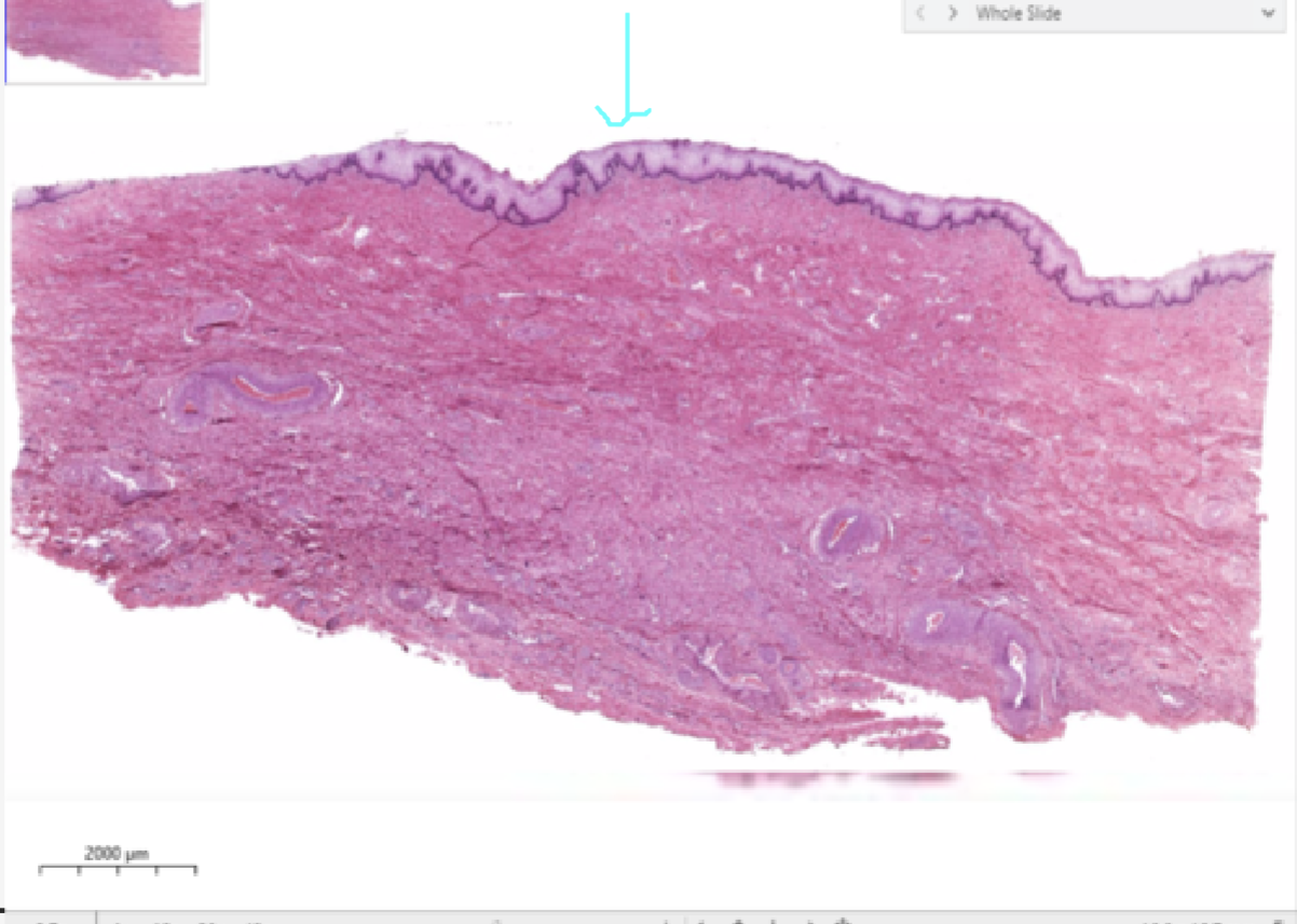 <p>identify the mucosa</p>