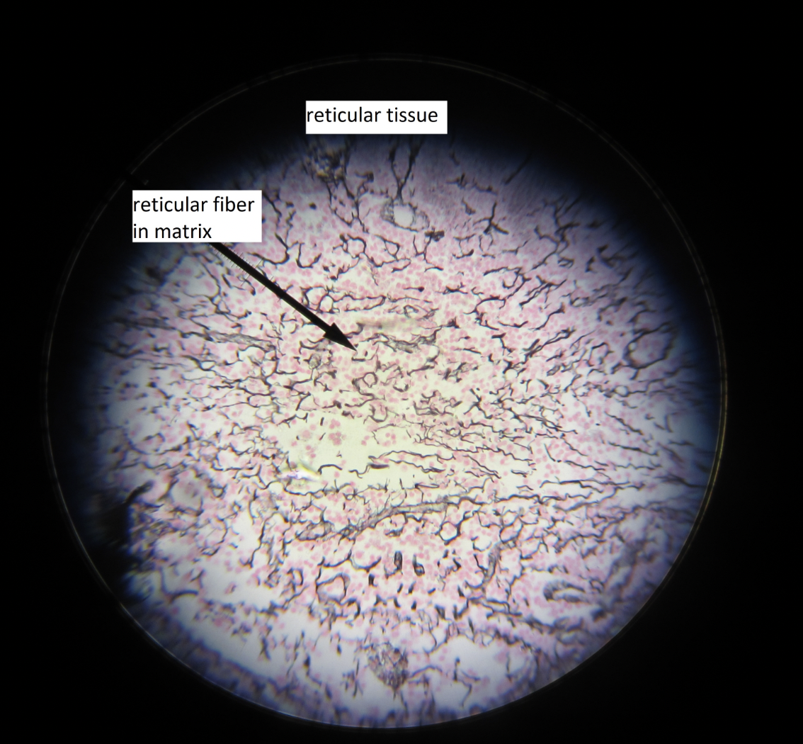 <p>reticular tissue, forms soft internal skeleton, ex: lymph nodes</p>