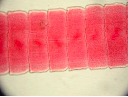 <p>What region of <em>Taenia</em> is this?</p>