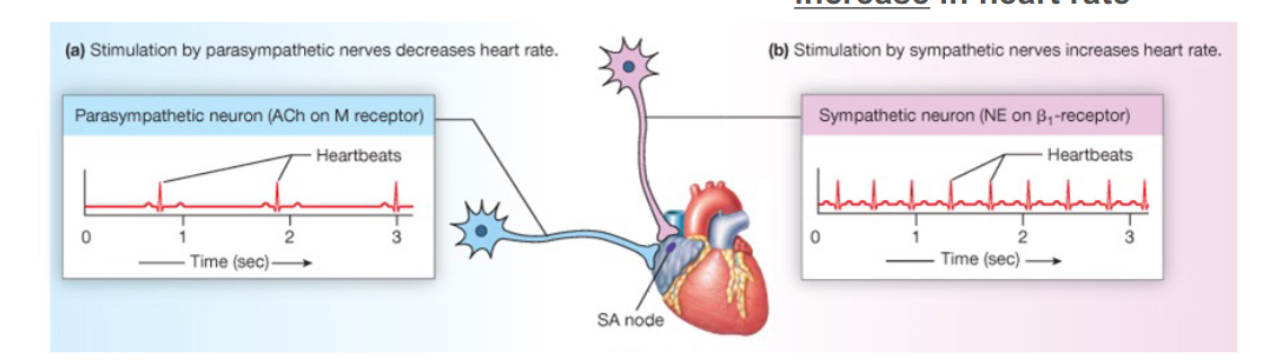 <p>Parasympathetic stimulation of the SA node conducting cells…</p>