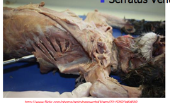 <p>muscle that serves to suspend the thorax</p>