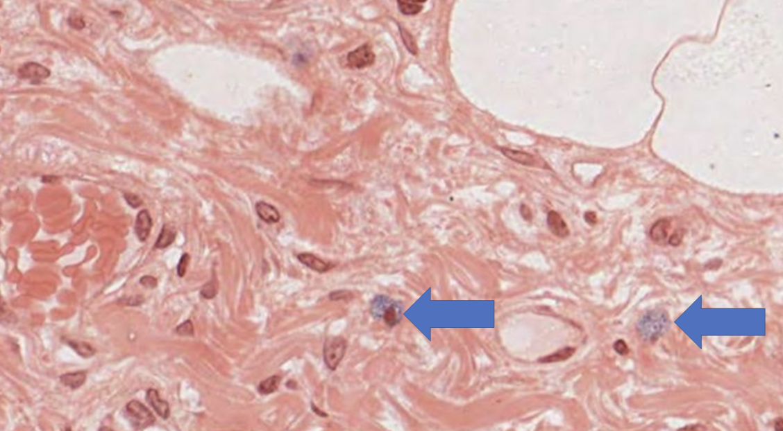 <p><span>The arrows are pointing to which cells?</span>&nbsp;</p><p>-Plasma Cells</p><p>-Mast Cells</p><p>-Macrophages</p><p>&nbsp;-Neutrophils</p><p>-Lymphocytes</p>