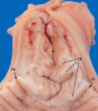 <p>Which species cervix is this</p>