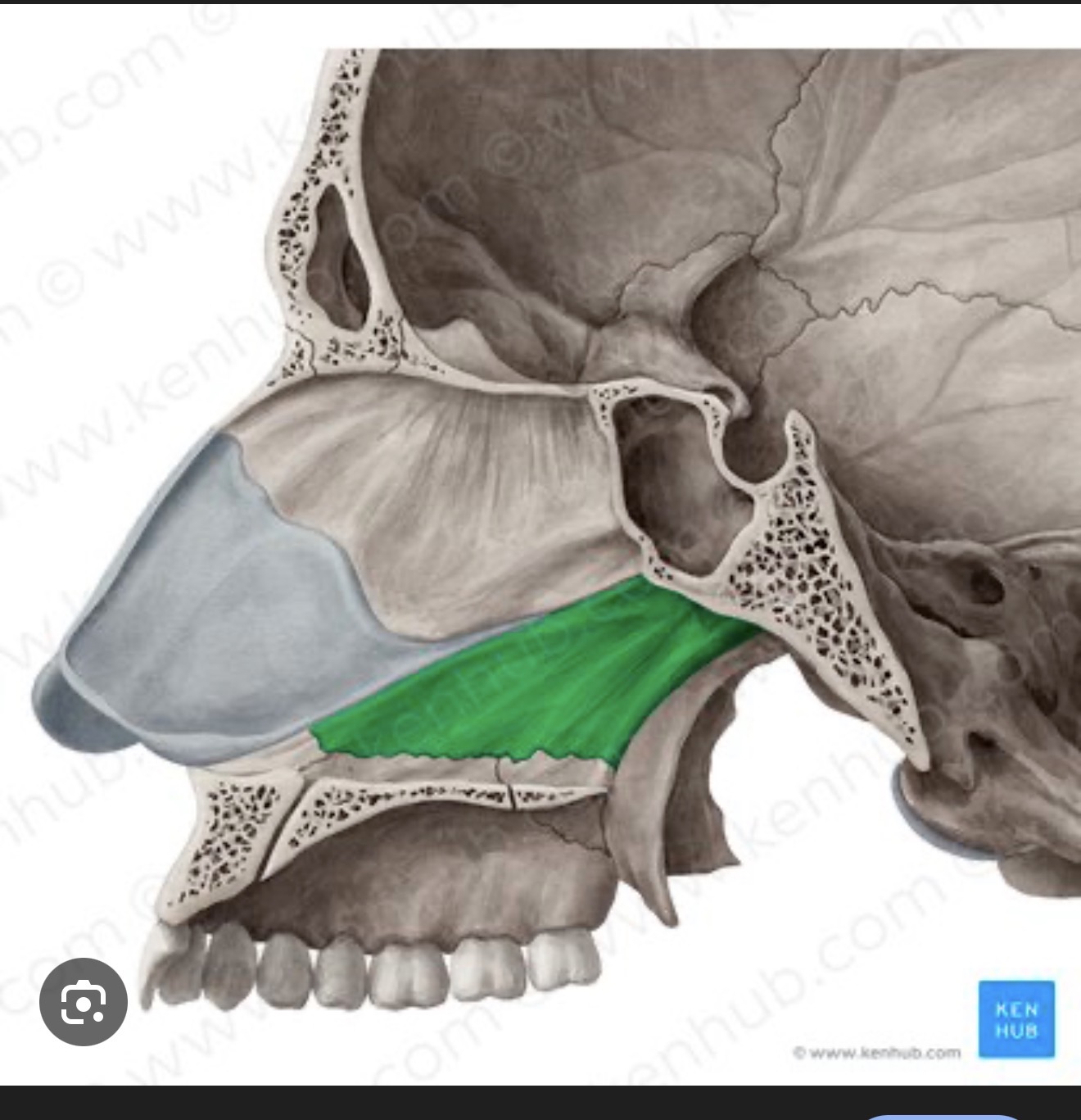 <p>what is this ? R/L </p>