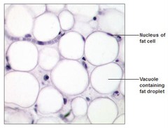 <p>Description: matrix as in areolar, but very sparse</p><p>Function: provides reserve food fuel</p><p>Location: under skin, around kidneys and eyeball, abdomen and breast</p>