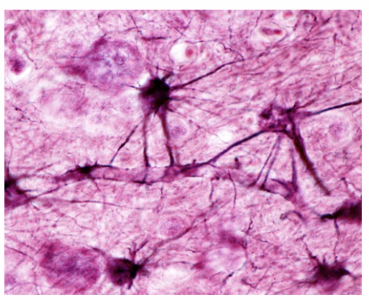 <p>Astrocyte: Function: <span>Support neurons, maintain the blood-brain barrier, regulate chemicals, and help repair the CNS.</span></p>