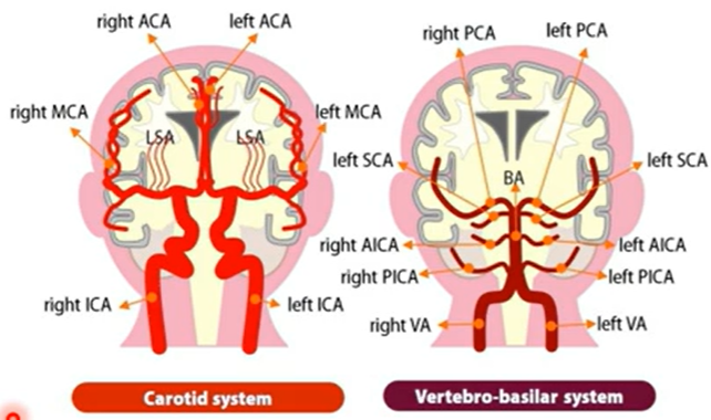 <p>The brain is highly dependent on a continuous supply of <span style="color: purple;">oxygen and glucose </span>delivered through cerebral blood flow.</p><p>The two systems are <span style="color: purple;">carotid and vertebro-basilar</span></p><p></p><p>Even <span style="color: purple;">brief interruptions in blood supply have severe consequen</span>ces.<strong> If cerebral blood flow stops for 5–10 seconds, loss of consciousness occurs</strong>, and <strong>after approximately 3 minutes</strong>, <span style="color: purple;">irreversible </span>neuronal injury and brain damage can develop due to oxygen deprivation.</p><p></p><p>Despite fluctuations in systemic blood pressure, the brain maintains a relatively stable blood supply through a process called <span style="color: purple;">cerebral autoregulation</span></p><p></p><p>Within a mean arterial pressure (MAP) range of approximately <strong>60–140 mmHg,</strong> cerebral blood flow remains nearly constant at around<strong> 750 ml/min</strong>. This stability is achieved by adjustments in<span style="color: purple;"> <strong>cerebral vascular resistance</strong></span>—blood vessels constrict when blood pressure rises and dilate when it falls</p>