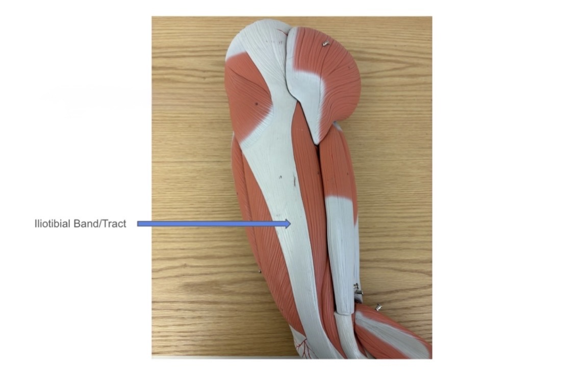 <p>grey under tensor fasciae latae</p>