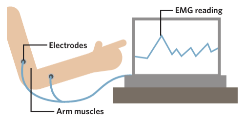 <p><span style="background-color: inherit; line-height: 20.7px; color: windowtext;">An electromyograph (EMG) is a device that detects, amplifies, and records the electrical activity of the body’s skeletal muscles</span><span style="line-height: 20.7px; color: windowtext;"> </span></p><ul><li><p class="Paragraph SCXO105878677 BCX0" style="text-align: left;"><span style="background-color: inherit; line-height: 20.7px; color: windowtext;">This is done by attaching electrodes to the skin above the muscles under investigation, the movement and tension of muscles are recorded</span><span style="line-height: 20.7px; color: windowtext;"> </span></p></li></ul><p class="Paragraph SCXO105878677 BCX0" style="text-align: left;"><span style="line-height: 20.7px; color: windowtext;"> </span></p><p class="Paragraph SCXO105878677 BCX0" style="text-align: left;"><span style="background-color: inherit; line-height: 20.7px; color: windowtext;">TIP: To remember what EMG measures --> think of the middle letter 'M' --> as 'm'uscles</span><span style="line-height: 20.7px; color: windowtext;"> </span></p>