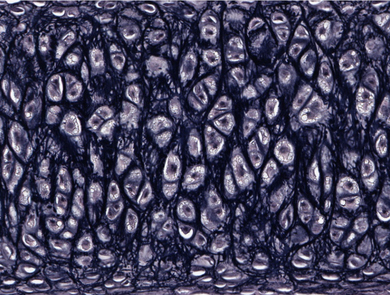<p><span style="font-family: "Calibri Light";">This cartilage has been stained to highlight fibers that make this tissue more flexible. <br><br>What fibers are they and what type of cartilage is this?</span></p>