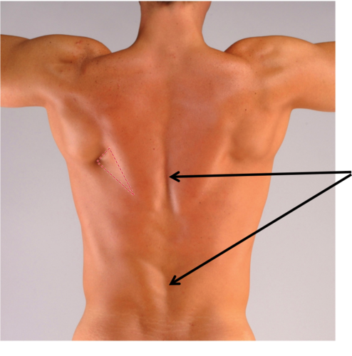 <p>Back indent</p>