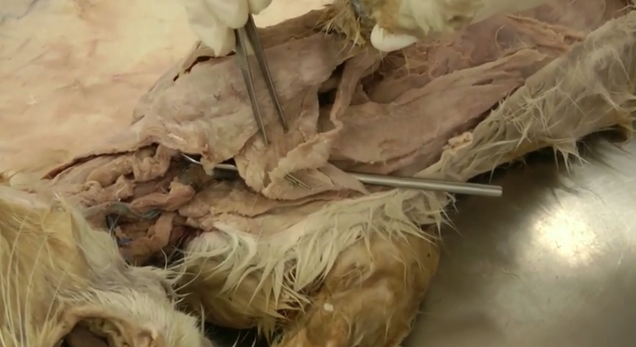 <p>Muscle being pointed to by tweezers</p>