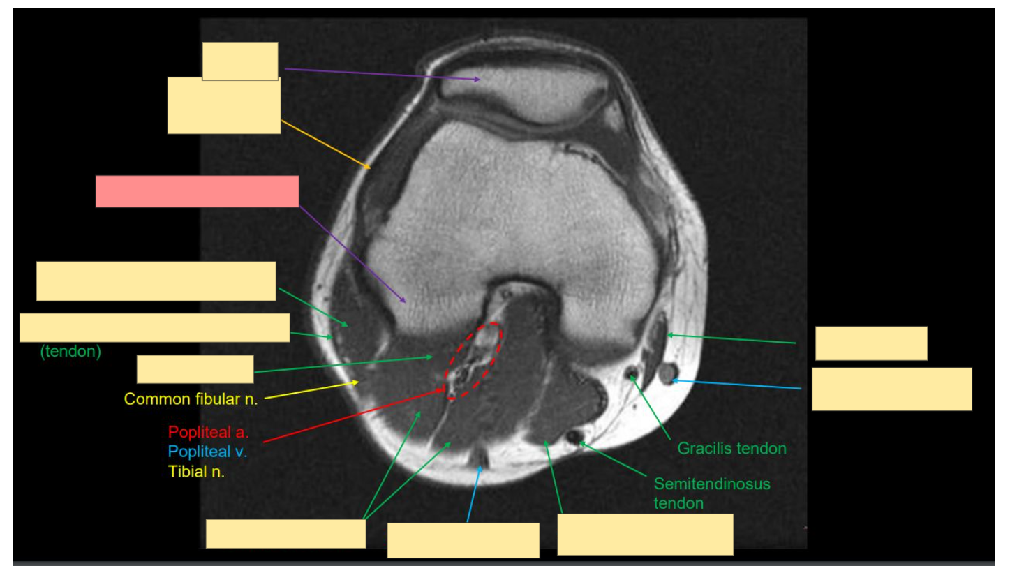 <p>Identify this structure</p>