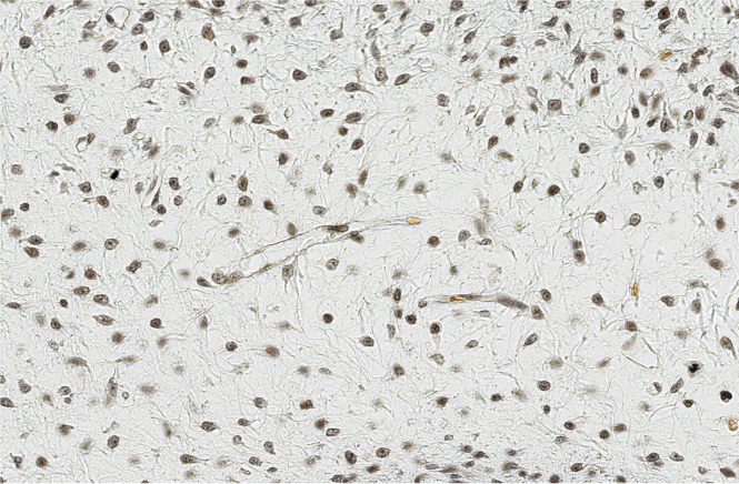 <p><span style="font-family: "Calibri Light";">ID the embryonic CT.</span></p>