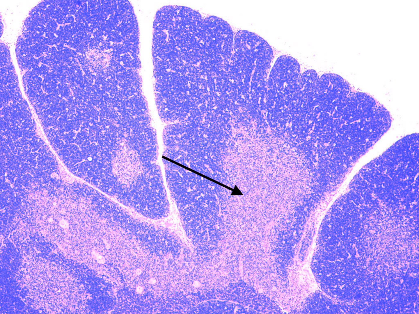 <p>What is the arrow pointing to?</p>
