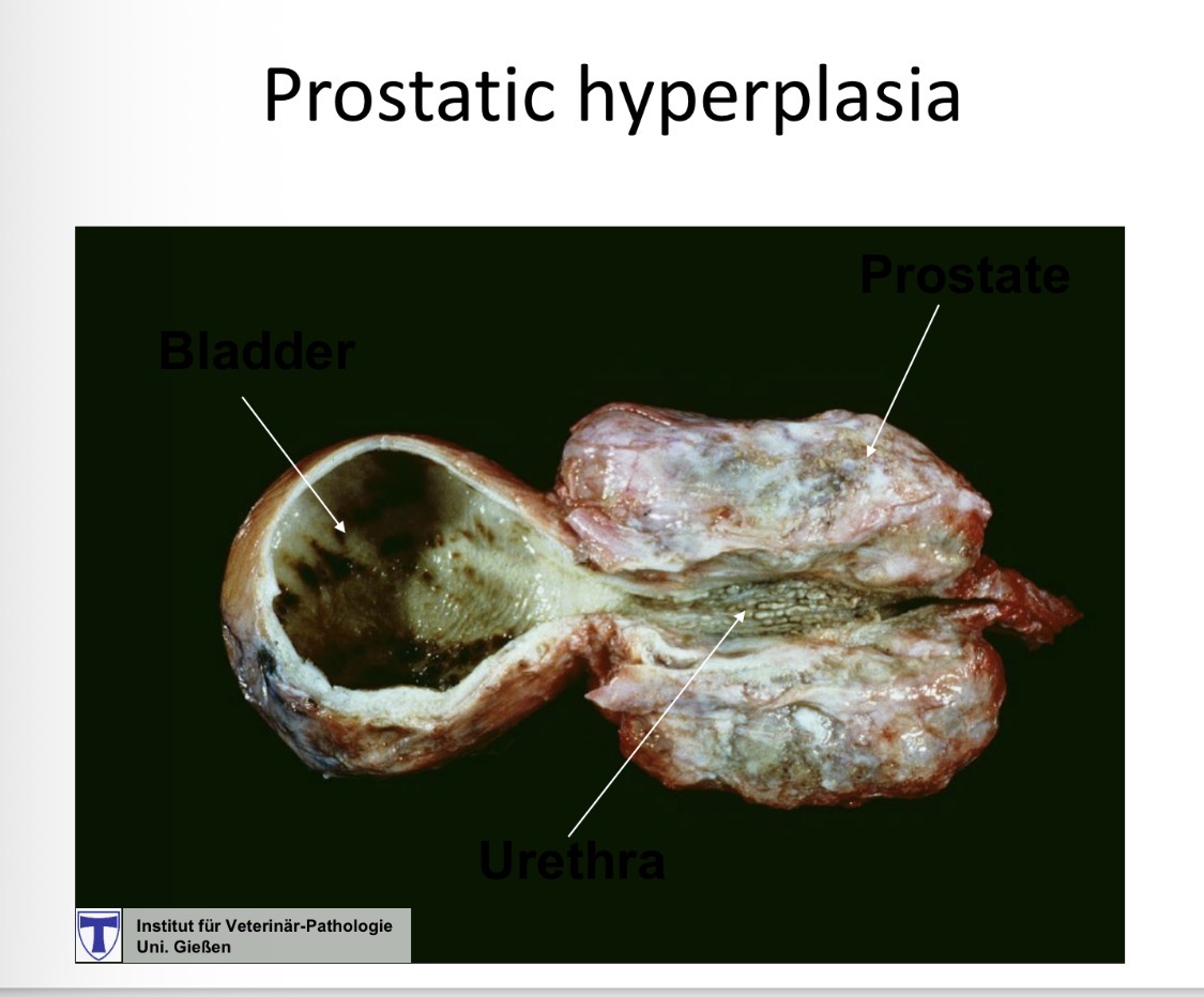 <p>prostatic hyperplasia - gross</p>