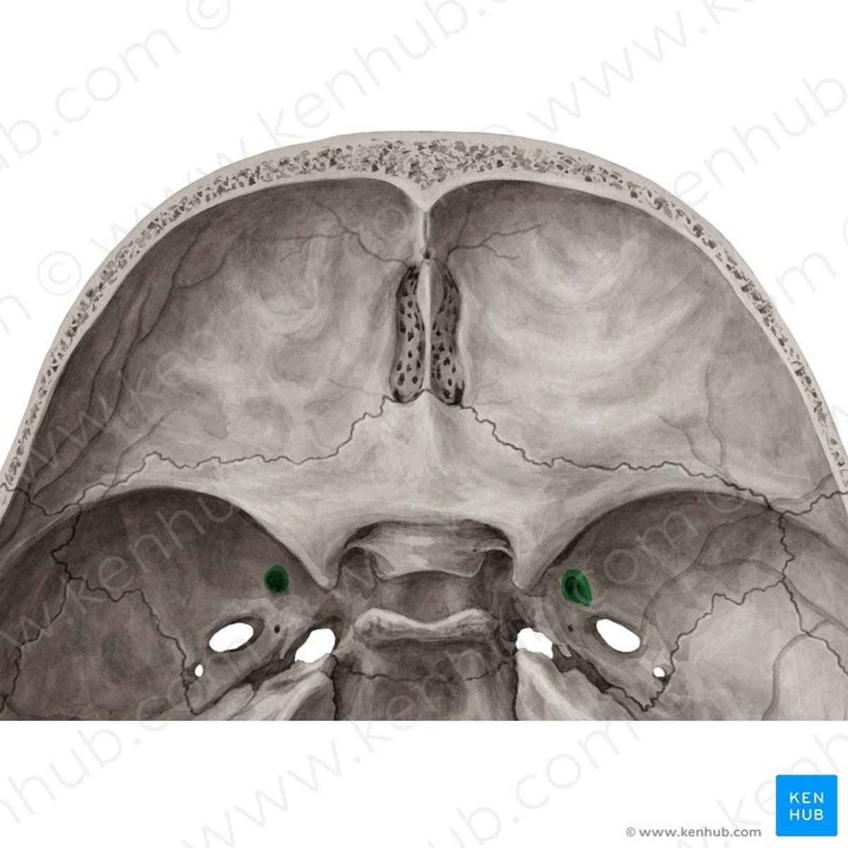 <p>Name this foramen.</p>
