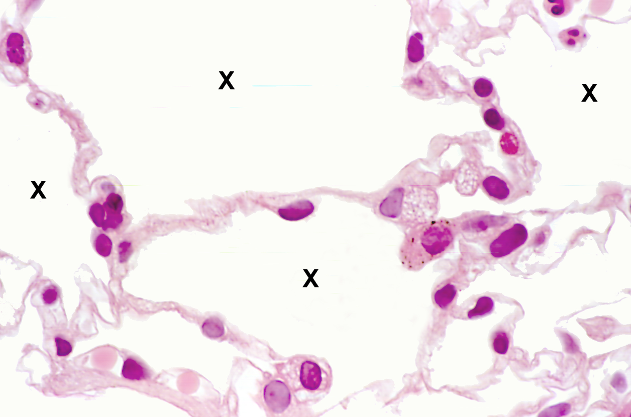 <p>Lung tissue</p><p><strong>NOTICE: THE OPEN SPACE OF THE ALVEOLI</strong></p>
