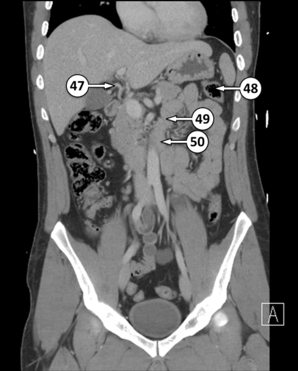 <p>What artery is number 47?</p>