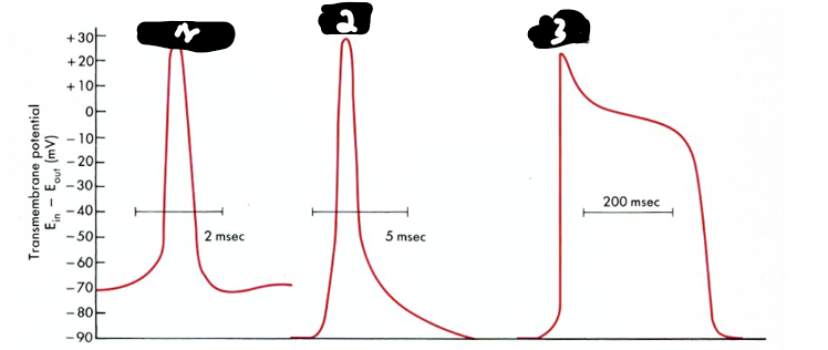 <p>which one is cardiac ventricle?</p>