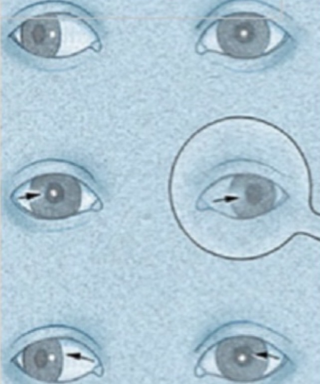 <p>Qu'est-ce que ce test permet de diagnostiquer ?</p><p></p><p>A. ﻿﻿﻿Une tropie</p><p>B. Une phorie</p><p>C. Une lésion de l'axe visuel</p><p>D. Une ptose</p>