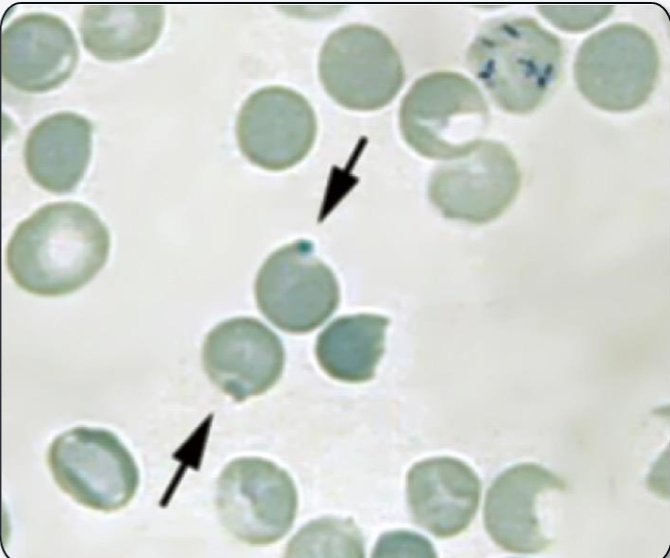 <p>What cellular inclusion is shown? What is it composed of? What anemia is it most associated with?</p>