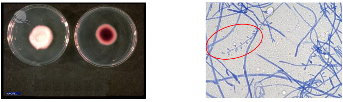 <p>Aspect Macroscopique :</p><ul><li><p>Recto = Blanc, aspect duveteuse</p></li><li><p>Verso = Blanc à rose pâle (Théoriquement rouge vin)</p></li></ul><p></p><p>Aspect microscopique:</p><ul><li><p>Macroconidies rare, en massue et paroi fine</p></li><li><p>Microconidies piriforme en <span style="color: rgb(85, 231, 39);"><strong><em><u>acladium</u></em></strong></span></p></li><li><p>Filaments mycéliens septés</p></li></ul><p></p>