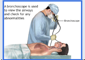 <p><span style="background-color: transparent;">Bronchoscopy</span></p><p></p>