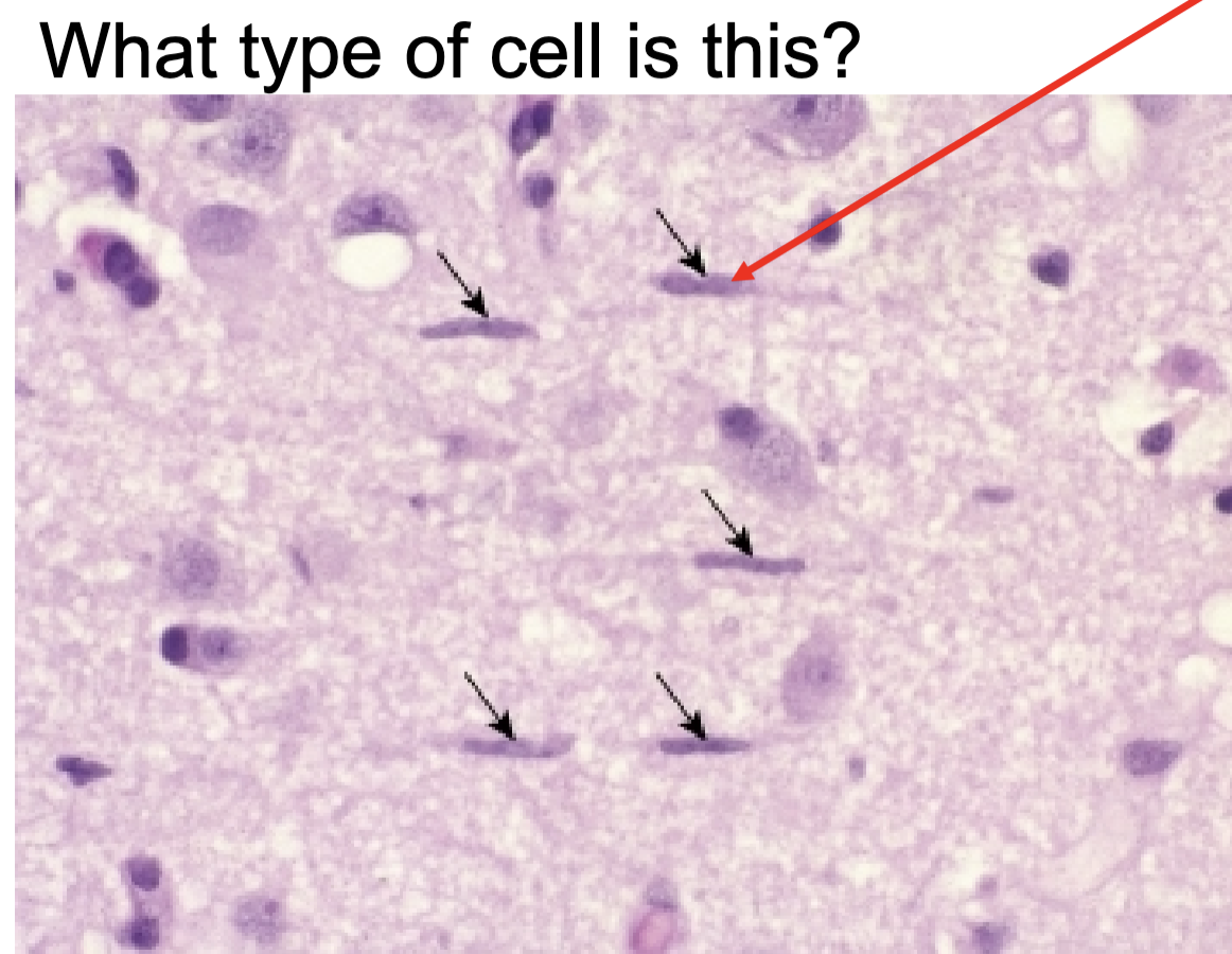 <p>Microglial cells</p>