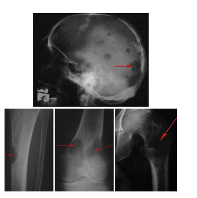 <p>Bone Survey</p>