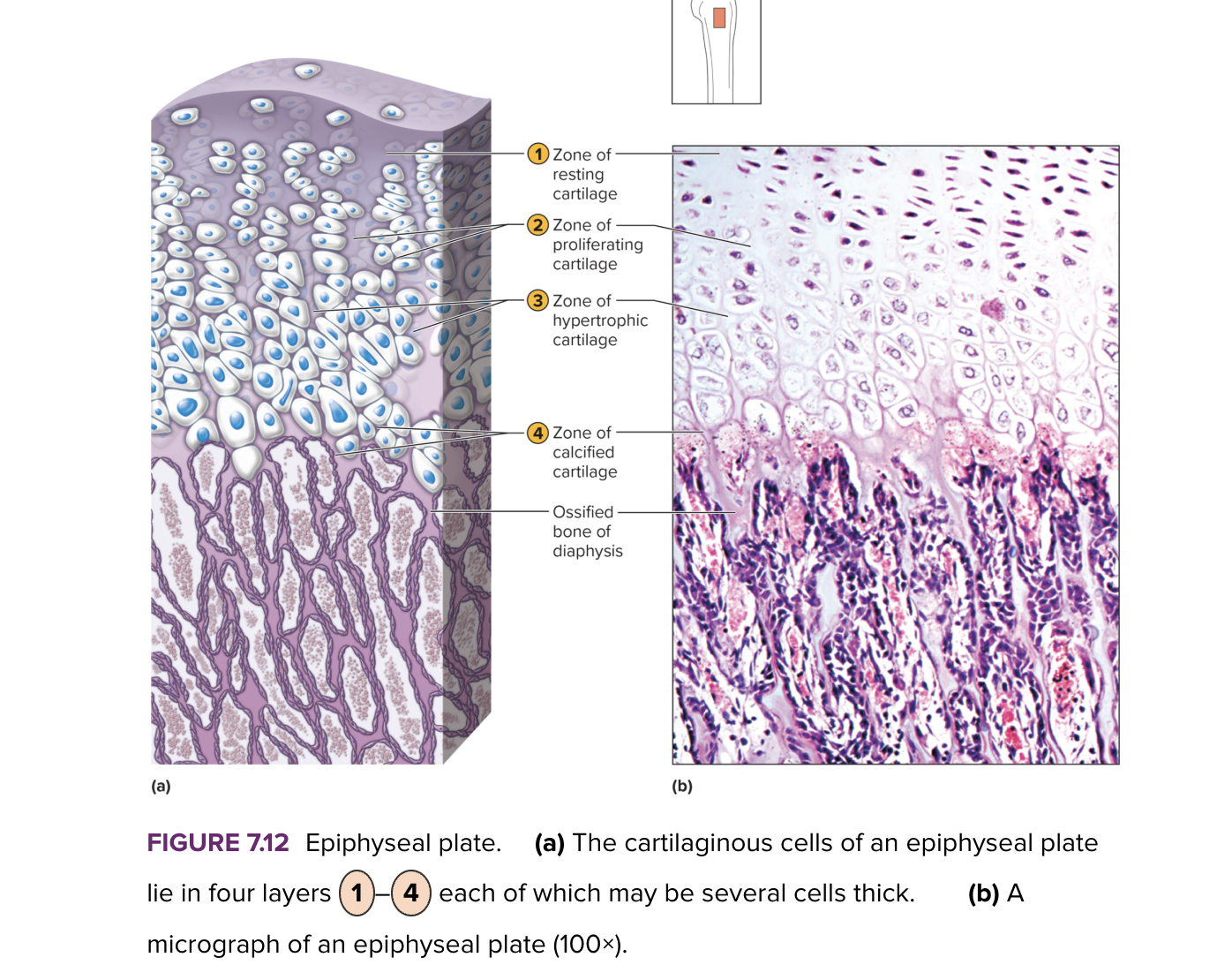 <p>first layer of cells </p><p>closet to end of epiphysis </p><p>resting cells </p><p>anchors epiphysis plate to epiphysis </p>