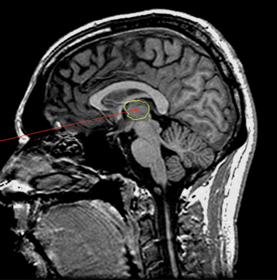 <p>What is the area highlighted called?</p>