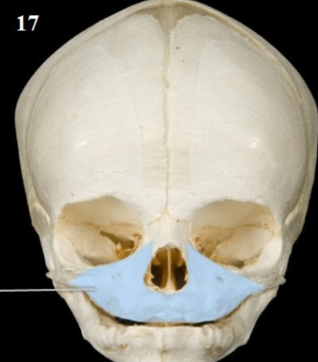 <p>Name This Bone</p>