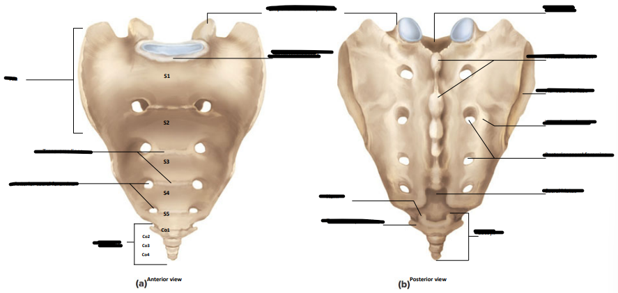 <p>Label the following;</p><ul><li><p>ala</p></li><li><p>transverse lines</p></li><li><p>anterior sacral foramina</p></li><li><p>coccyx</p></li><li><p>sacral promontory</p></li><li><p>superior articular process</p></li><li><p>sacral canal</p></li><li><p>median sacral crest</p></li><li><p>articular surface</p></li><li><p>lateral sacral crest</p></li><li><p>posterior sacral foramina</p></li><li><p>sacral hiatus</p></li><li><p>horn</p></li><li><p>transverse process</p></li></ul><p></p>