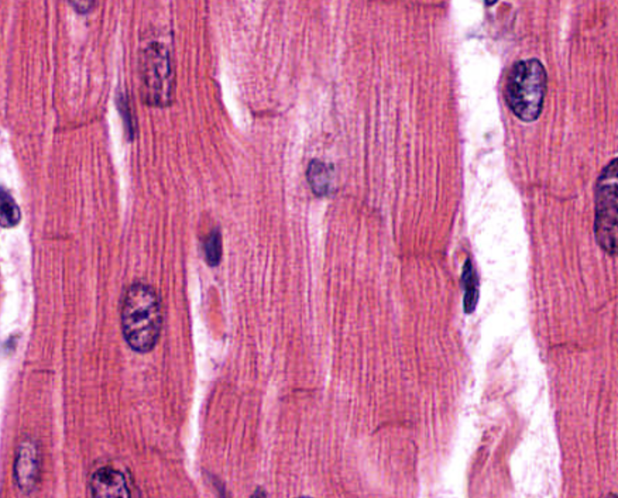 <p><strong>The dark lines connecting cardiac muscle cells are called __________</strong></p>