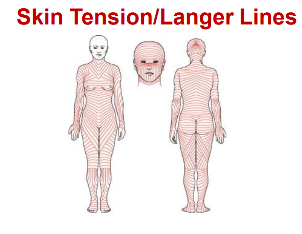 <p>Along skin tension lines / Langer lines</p>