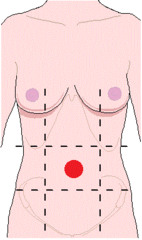 <p>small intestine, duodenum, umbilicus</p>